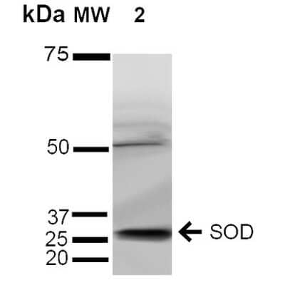 Western Blot: SOD3/EC-SOD Antibody [NBP3-18234]